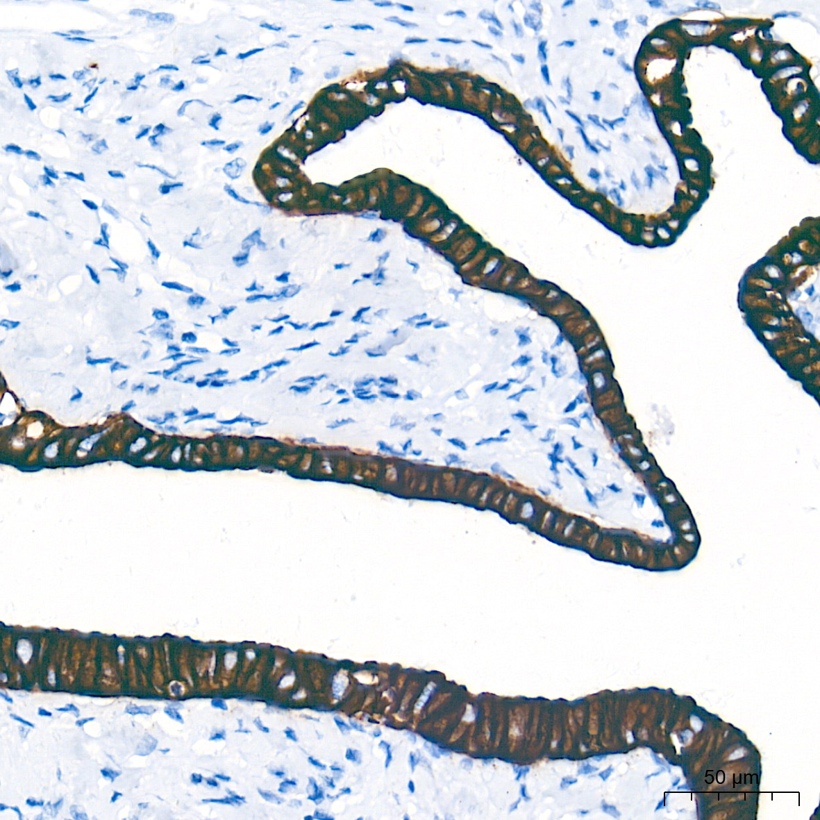 Cytokeratin 19 (CK19) Rabbit mAb