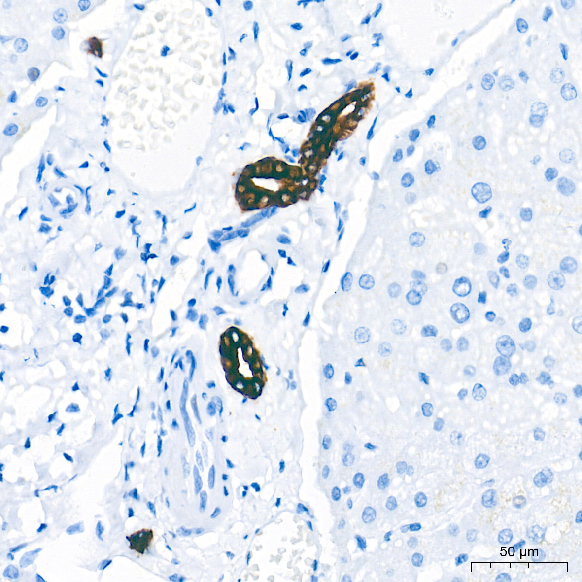 Cytokeratin 19 (CK19) Rabbit mAb