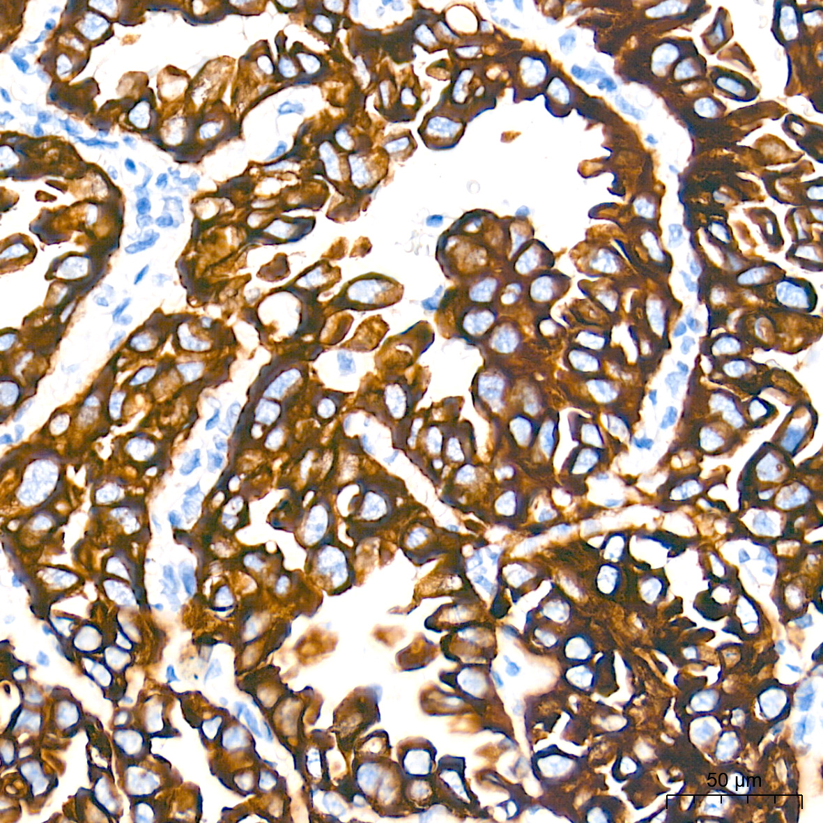 Cytokeratin 19 (CK19) Rabbit mAb