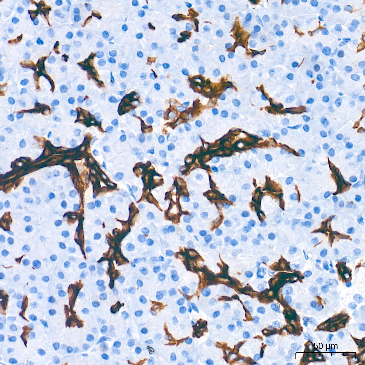 Cytokeratin 19 (CK19) Rabbit mAb