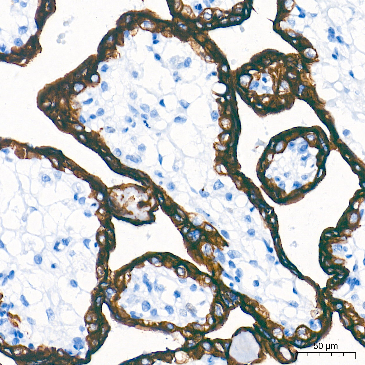 Cytokeratin 19 (CK19) Rabbit mAb