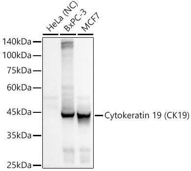 Cytokeratin 19 (CK19) Rabbit mAb