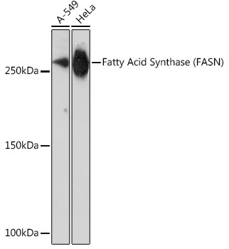 Fatty Acid Synthase (FASN) Rabbit mAb