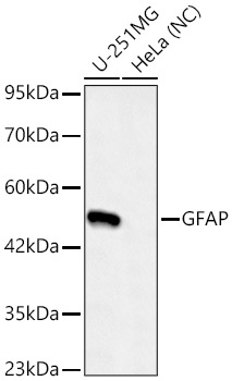 GFAP Rabbit mAb