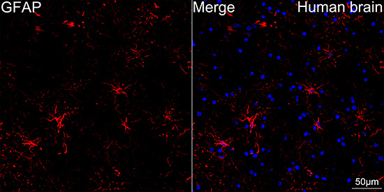 GFAP Rabbit mAb