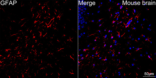 GFAP Rabbit mAb