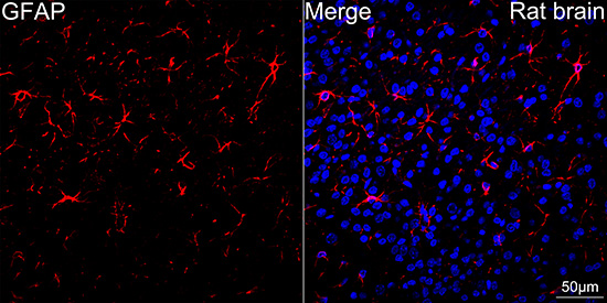 GFAP Rabbit mAb