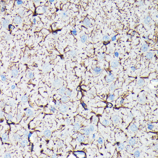 GFAP Rabbit mAb