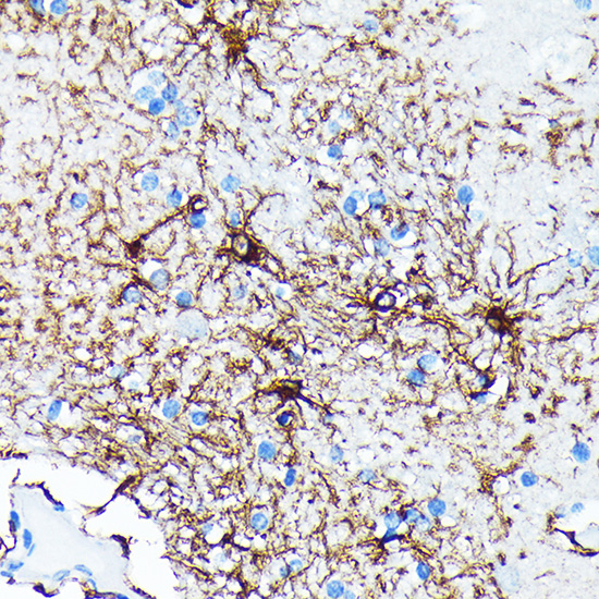 GFAP Rabbit mAb