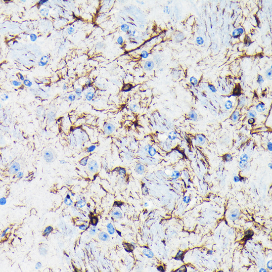 GFAP Rabbit mAb