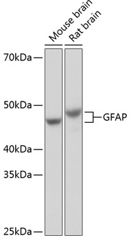 GFAP Rabbit mAb