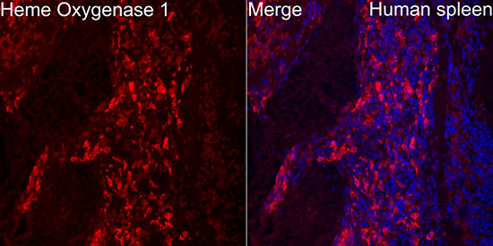 [KD Validated] Heme Oxygenase 1 (HO-1/HMOX1) Rabbit mAb