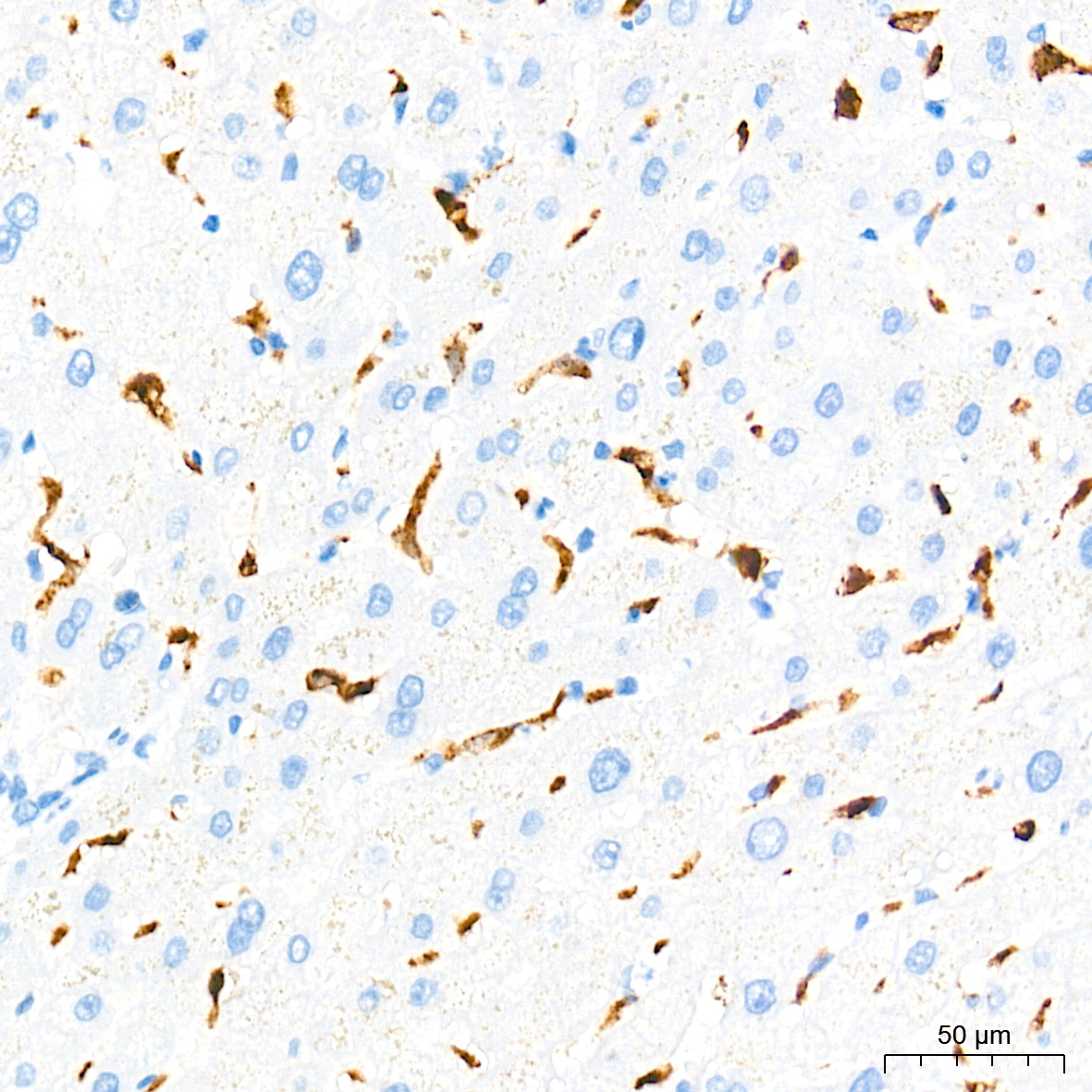 [KD Validated] Heme Oxygenase 1 (HO-1/HMOX1) Rabbit mAb