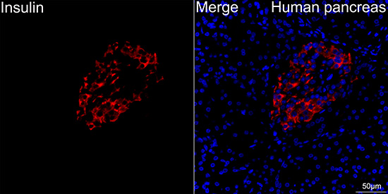 Insulin Rabbit mAb