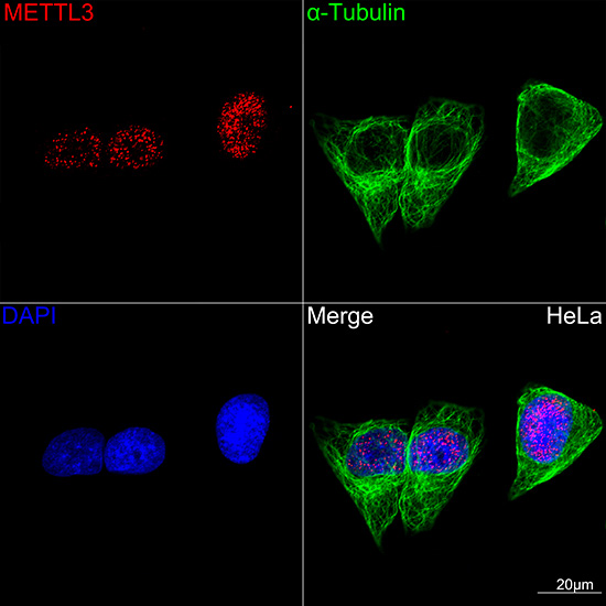 METTL3 Rabbit mAb