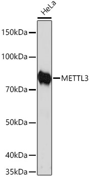 METTL3 Rabbit mAb