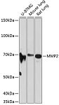 Western blot - MMP2 Rabbit mAb (A19080)