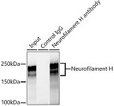 Western blot - Neurofilament H Rabbit mAb (A19084)