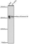 Western blot - Neurofilament M Rabbit mAb (A19085)