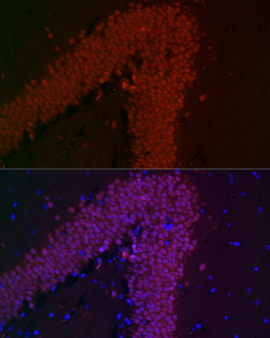 NeuN Rabbit mAb