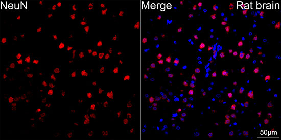 NeuN Rabbit mAb