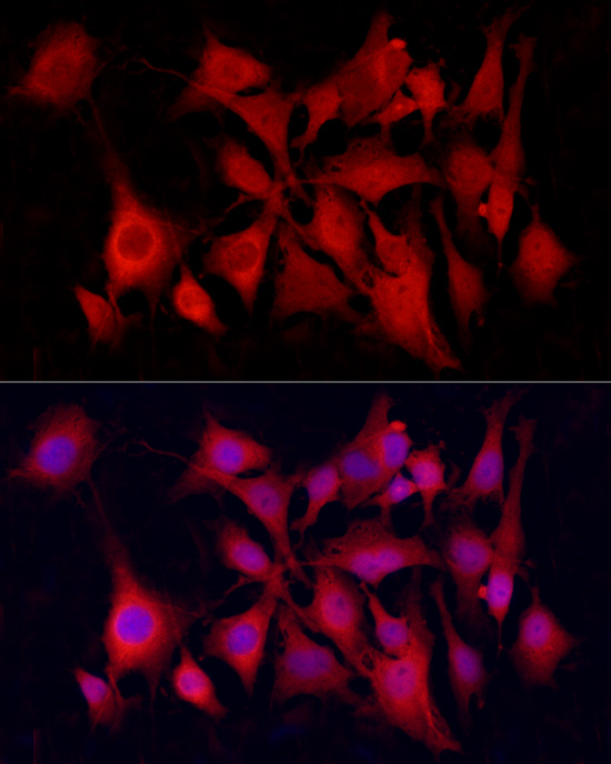 PGP9.5/UCHL1 Rabbit mAb