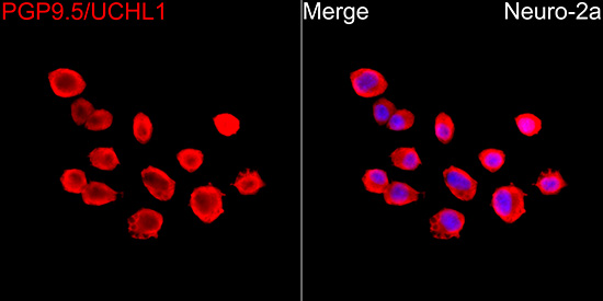 PGP9.5/UCHL1 Rabbit mAb