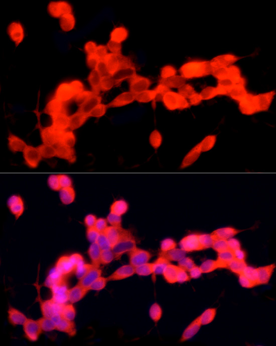 PGP9.5/UCHL1 Rabbit mAb