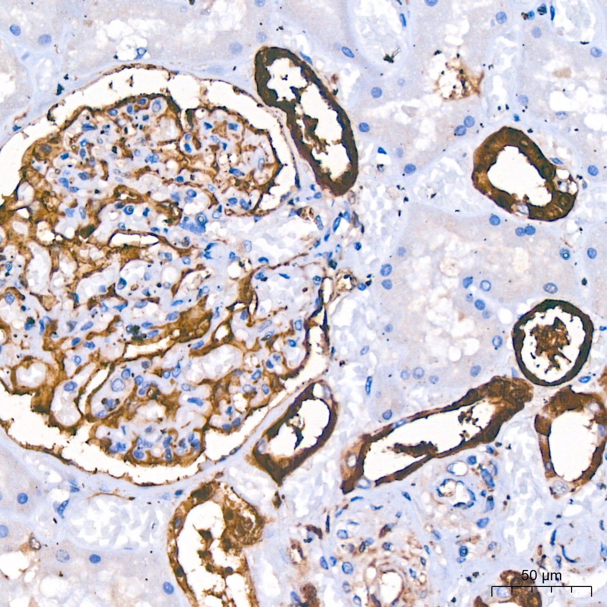 PGP9.5/UCHL1 Rabbit mAb