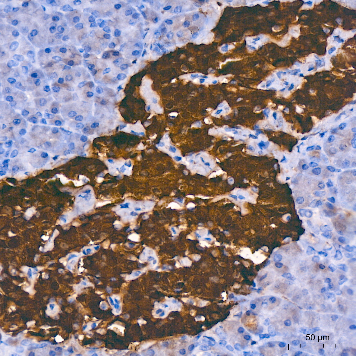 PGP9.5/UCHL1 Rabbit mAb