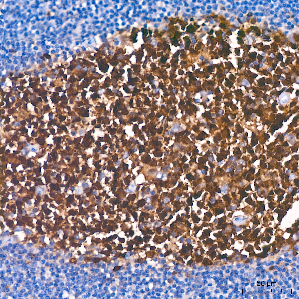 PGP9.5/UCHL1 Rabbit mAb