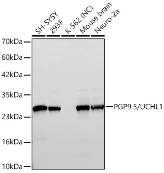 PGP9.5/UCHL1 Rabbit mAb