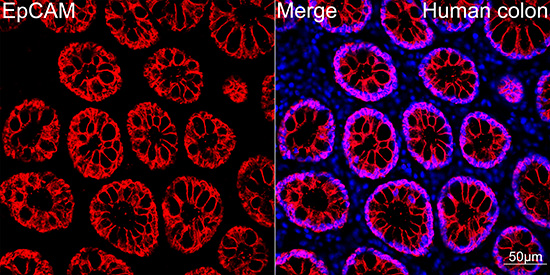 EpCAM Rabbit mAb