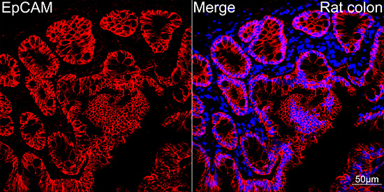 EpCAM Rabbit mAb