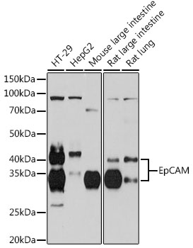 EpCAM Rabbit mAb