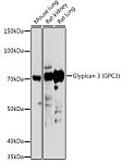 Western blot - Glypican 3 (GPC3) Rabbit pAb (A1946)