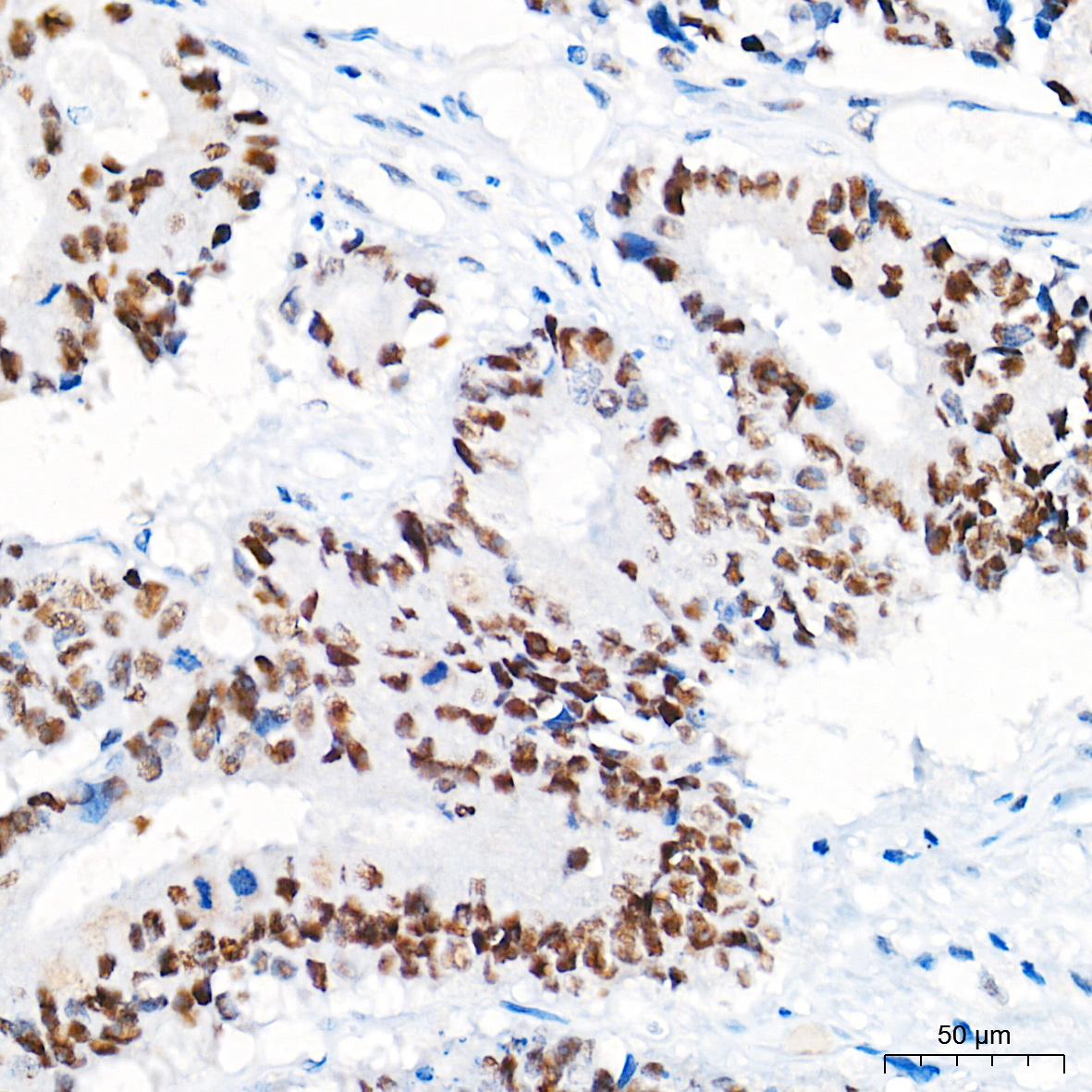 Chk2 Rabbit mAb