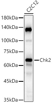 Chk2 Rabbit mAb