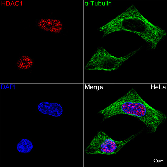 [KO Validated] HDAC1 Rabbit mAb