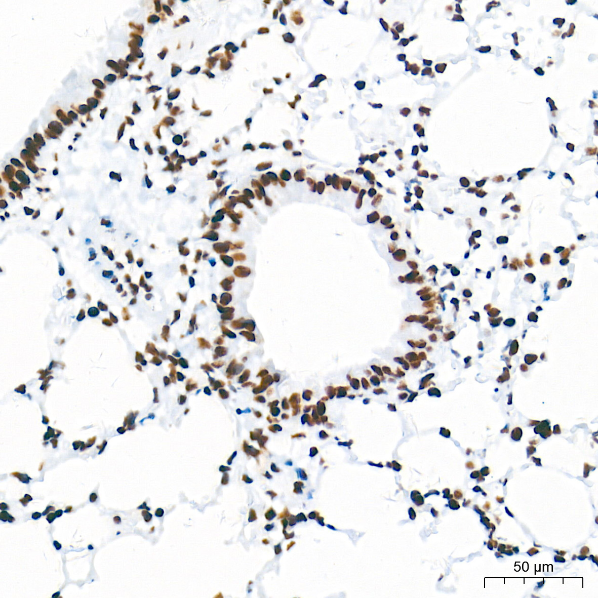 [KO Validated] HDAC1 Rabbit mAb