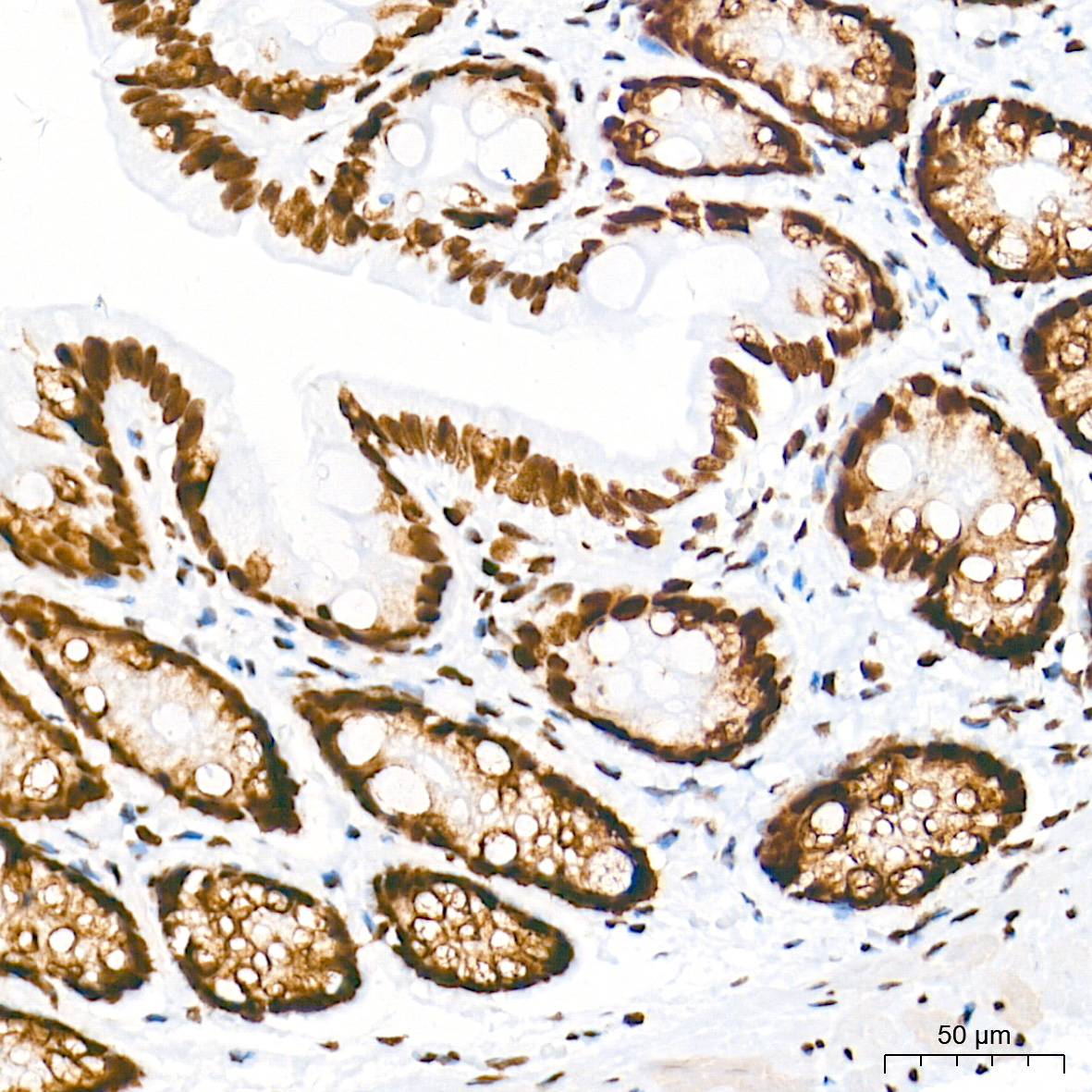 [KO Validated] HDAC1 Rabbit mAb