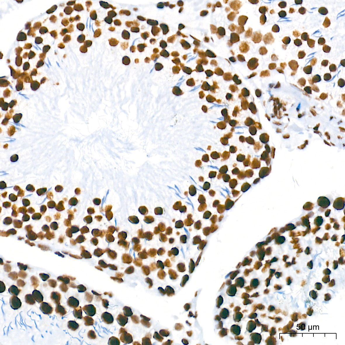 [KO Validated] HDAC1 Rabbit mAb