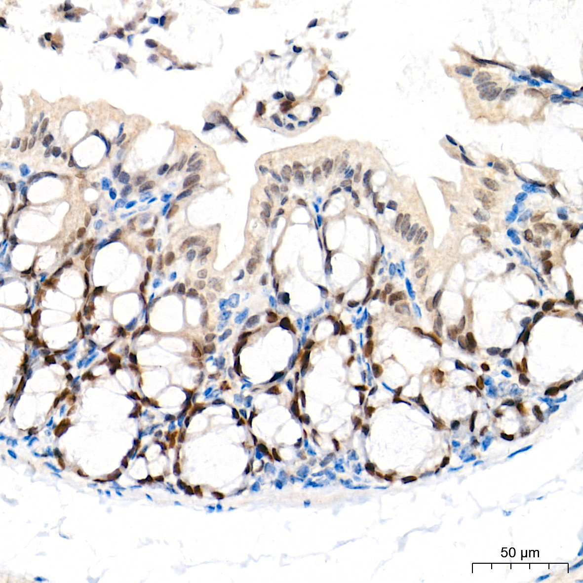 EZH2/KMT6 Rabbit mAb