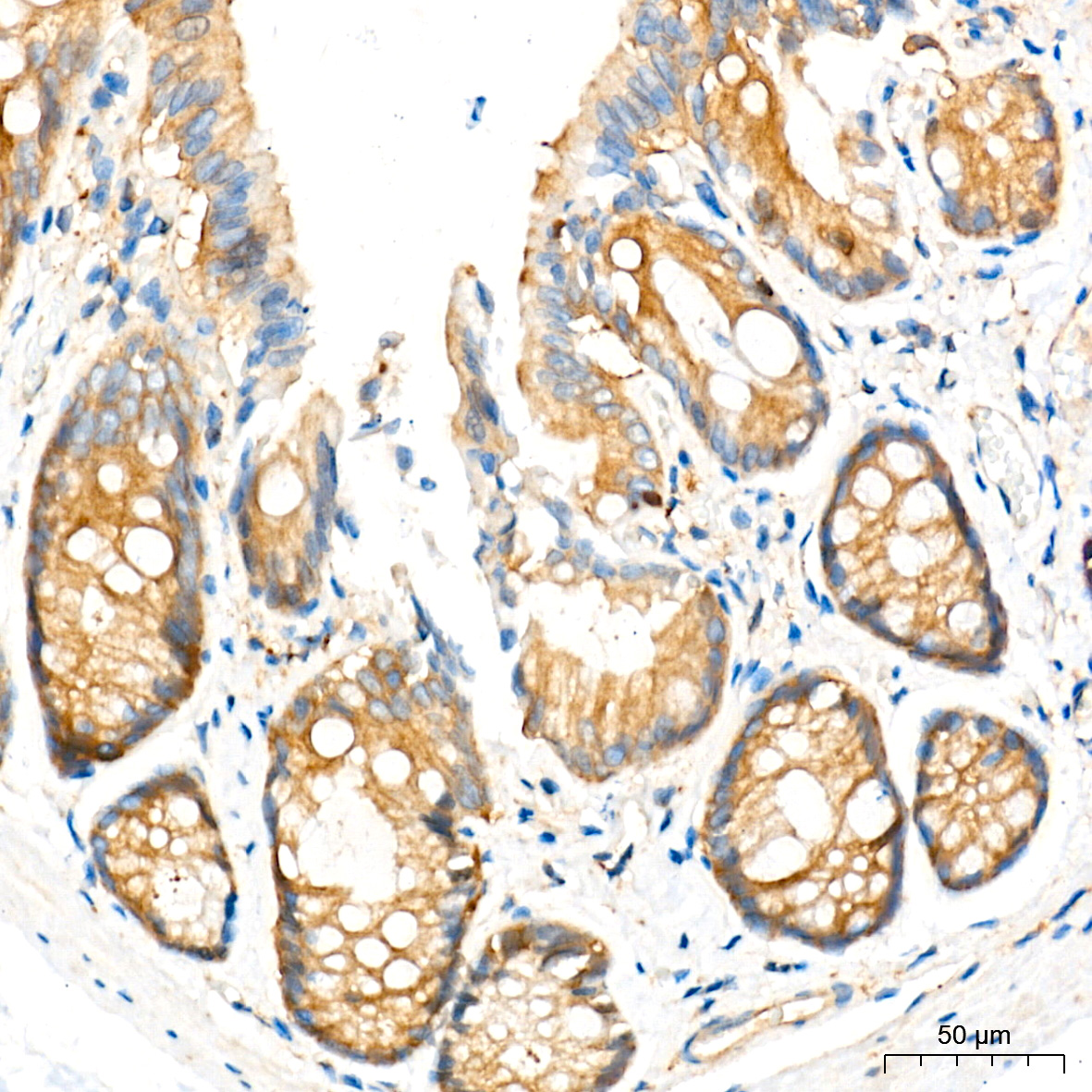 [KD Validated] ATG7 Rabbit mAb