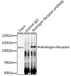 Western blot - Androgen Receptor Rabbit mAb (A19611)