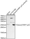 Western blot - Cleaved PARP1 p25 Rabbit mAb (A19612)