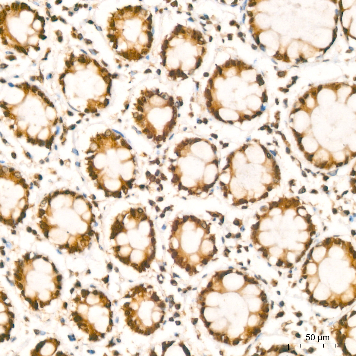 [KO Validated] HuR/ELAVL1 Rabbit mAb