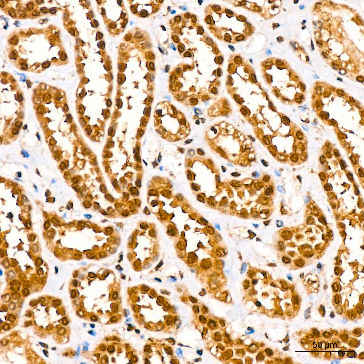 [KO Validated] HuR/ELAVL1 Rabbit mAb