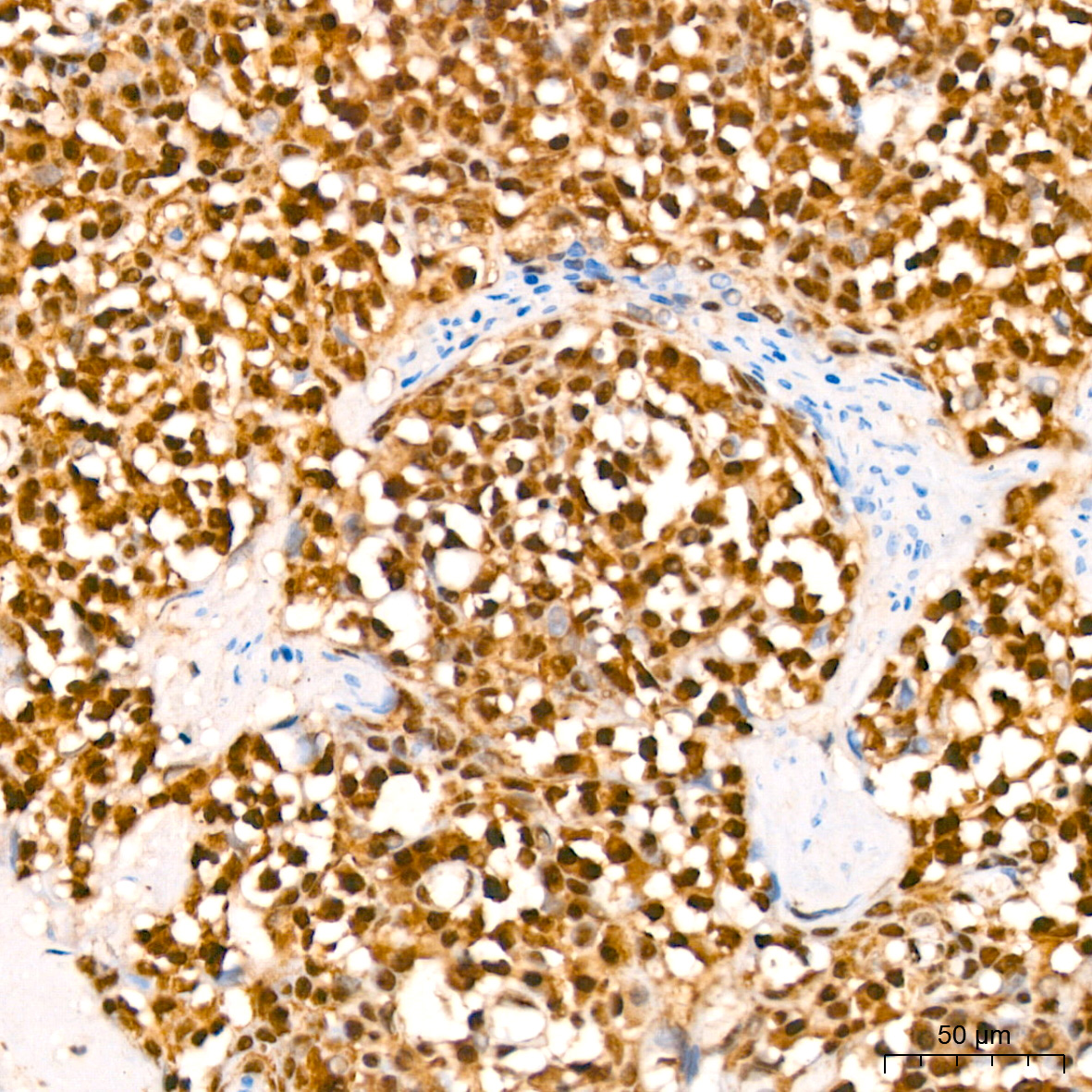 [KO Validated] HuR/ELAVL1 Rabbit mAb