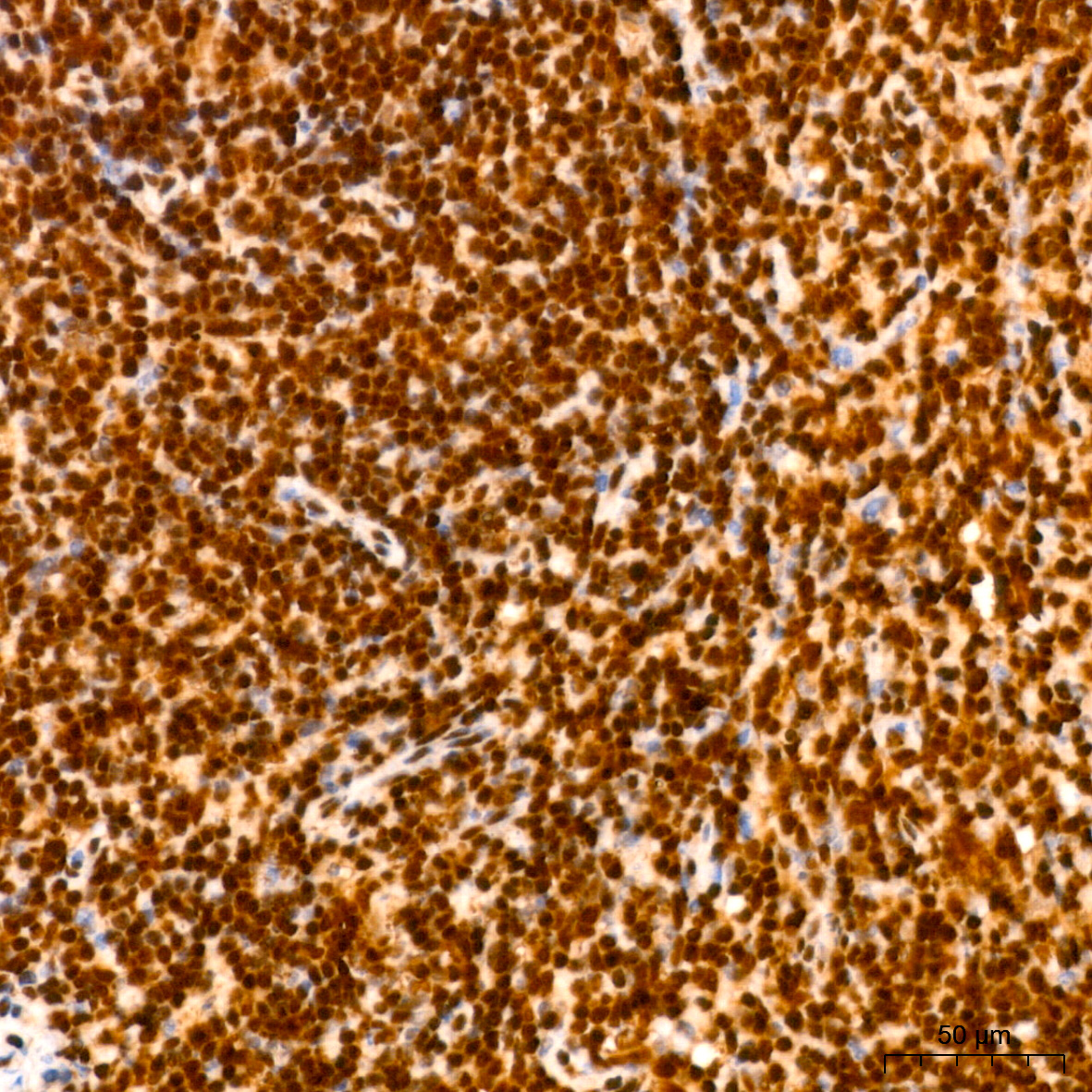 [KO Validated] HuR/ELAVL1 Rabbit mAb